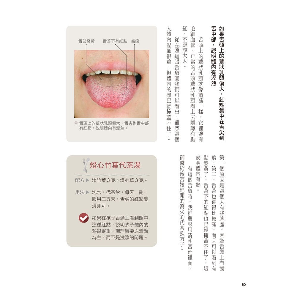 完全圖解：舌診看百病